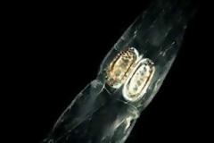 Απίστευτες φωτογραφίες: Αυτά τα τέρατα είναι στο νερό που πίνουμε!