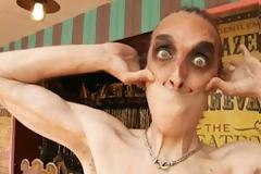 Ο άνθρωπος με το πιο… ελαστικό δέρμα!