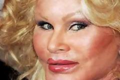 Πλαστική επέμβαση; Μήπως να το ξανασκεφτείτε;