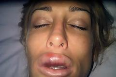 ΣΟΚ!! Μοντέλο πήγε για πλαστική στα χείλη και κατέληξε έτσι...