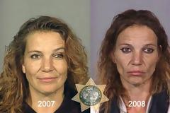 ΔΕΙΤΕ ΣΟΚΑΡΙΣΤΙΚΟ: Πως τα ναρκωτικά αλλάζουν την εμφανισή σου...