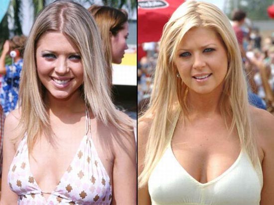 Celebrities πριν και μετά την πλαστική... - Φωτογραφία 19