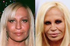 Celebrities πριν και μετά την πλαστική...