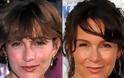 Celebrities πριν και μετά την πλαστική... - Φωτογραφία 10