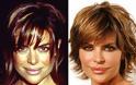 Celebrities πριν και μετά την πλαστική... - Φωτογραφία 16