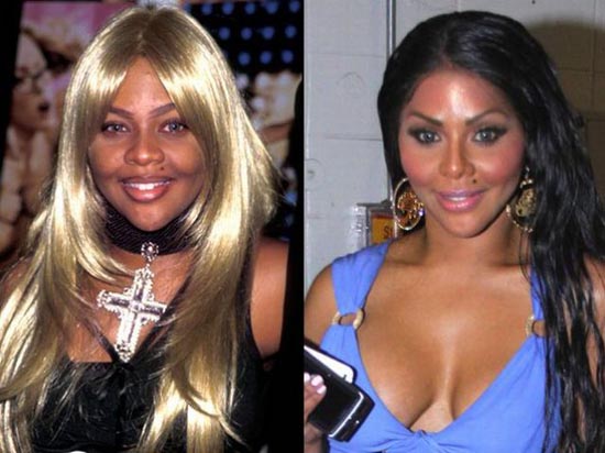 Celebrities πριν και μετά την πλαστική...  [ΦΩΤΟ] - Φωτογραφία 15