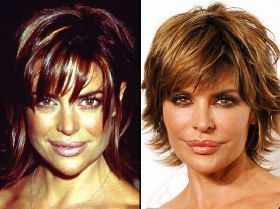Celebrities πριν και μετά την πλαστική...  [ΦΩΤΟ] - Φωτογραφία 16