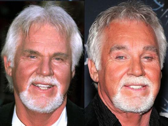 Celebrities πριν και μετά την πλαστική...  [ΦΩΤΟ] - Φωτογραφία 18