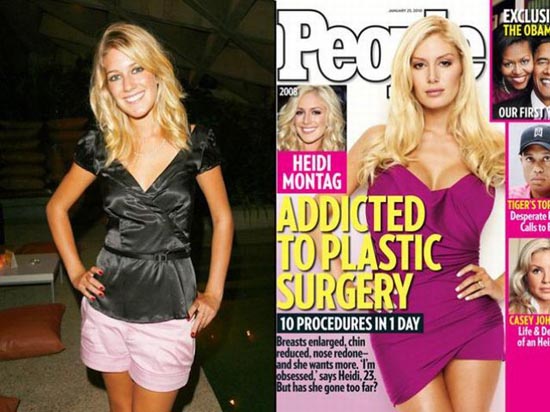 Celebrities πριν και μετά την πλαστική...  [ΦΩΤΟ] - Φωτογραφία 2