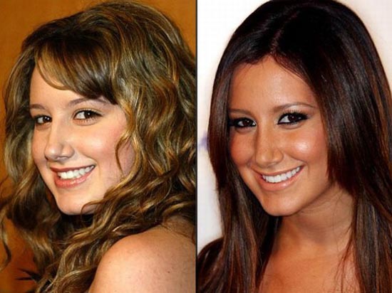 Celebrities πριν και μετά την πλαστική...  [ΦΩΤΟ] - Φωτογραφία 21