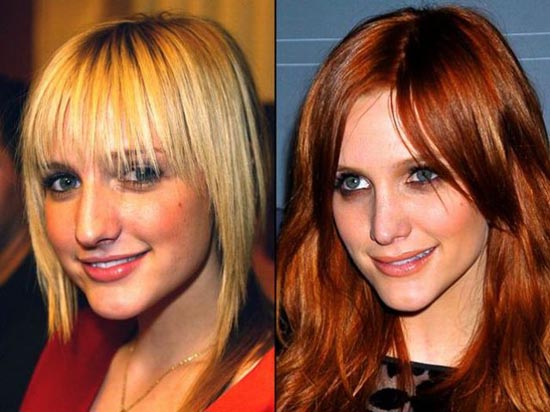 Celebrities πριν και μετά την πλαστική...  [ΦΩΤΟ] - Φωτογραφία 3