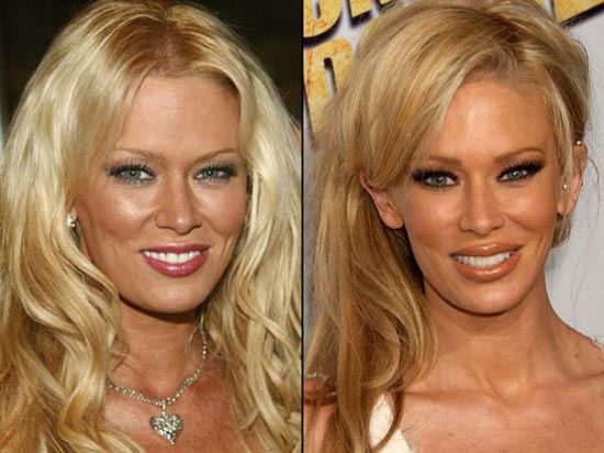 Celebrities πριν και μετά την πλαστική...  [ΦΩΤΟ] - Φωτογραφία 9