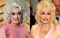 Celebrities πριν και μετά την πλαστική...  [ΦΩΤΟ] - Φωτογραφία 14