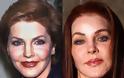 Celebrities πριν και μετά την πλαστική...  [ΦΩΤΟ] - Φωτογραφία 20