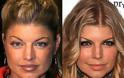 Celebrities πριν και μετά την πλαστική...  [ΦΩΤΟ] - Φωτογραφία 5