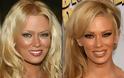 Celebrities πριν και μετά την πλαστική...  [ΦΩΤΟ] - Φωτογραφία 9