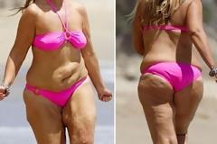 ΔΕΙΤΕ: Πώς είναι σήμερα αυτό το κορίτσι!