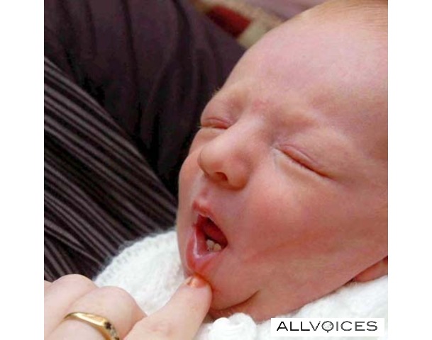 ΔΕΙΤΕ: Νεογέννητο μωρό με… δόντια! - Φωτογραφία 1