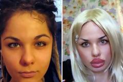 ΔΕΙΤΕ: Όταν οι πλαστικές επεμβάσεις πάνε στραβά…