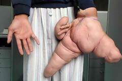 ΔΕΙΤΕ: 10 αποκρουστικές ασθένειες