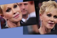Το πρόσωπό της Melanie Griffith, που σοκάρει!