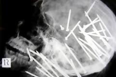 Ακτινογραφίες που σοκάρουν! [PHOTOS]