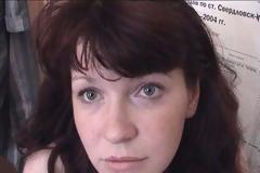 ΣΟΚΑΡΙΣΤΙΚΕΣ ΦΩΤΟΓΡΑΦΙΕΣ: Τρομακτική αλλαγή νεαρής ναρκομανούς σε 6 χρόνια