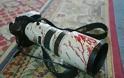 Δολοφονήθηκε δημοσιογράφος του Sana στη Δαμασκό