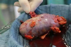 ΤΟ ΕΜΠΟΡΙΟ ΟΡΓΑΝΩΝ ΠΑΙΡΝΕΙ ΔΙΑΣΤΑΣΕΙΣ