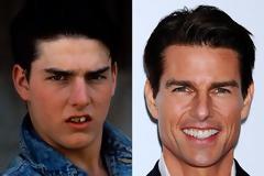 ΔΕΙΤΕ:  Η αλήθεια πίσω από τα λαμπερά χαμόγελα των stars