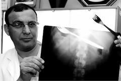 ΑΠΙΣΤΕΥΤΕΣ ΦΩΤΟΓΡΑΦΙΕΣ: Παράξενες ακτινογραφίες