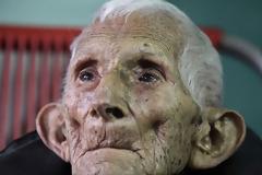 ΔΕΙΤΕ:  Άνδρας 111 ετών