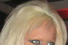 Όταν η πλαστική επέμβαση πάει πολύ στραβά..