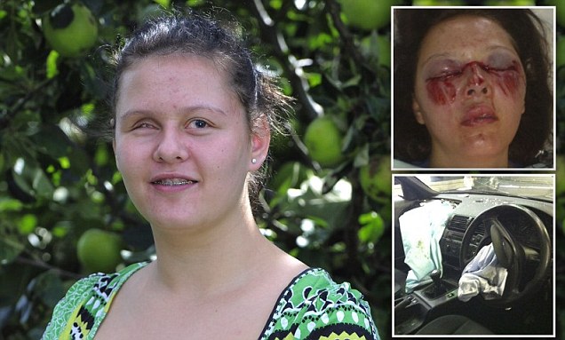 16χρονη τυφλώθηκε από αερόσακο!!! - Φωτογραφία 1
