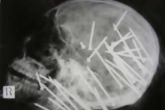 Απίστευτες ακτινογραφίες [ΦΩΤΟ]