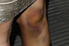 ΔΕΙΤΕ: Τι μπορεί να σου τύχρι στα καλά καθούμενα