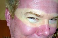 ΔΕΙΤΕ: Σε κάποιους δε θα λείψει η ηλιοθεραπεία