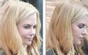 «Πάγωσε» από τα botox το πρόσωπο της Nicole Kidman!