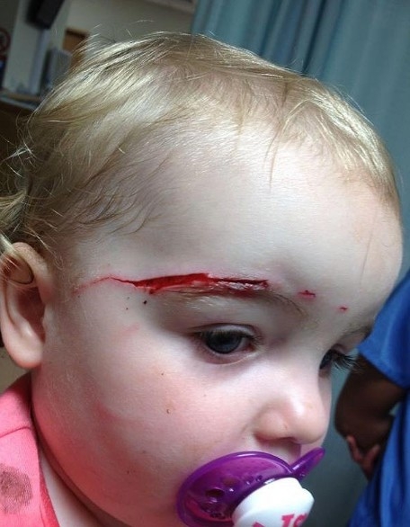 Γάτα όρμηξε στην κούνια του μωρού και του επιτέθηκε... Η μικρή χρειάστηκε 17 ράμματα - Φωτογραφία 2