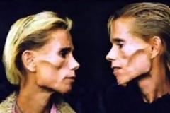 Τραγικό τέλος μες στις φλόγες για ανορεξικές δίδυμες