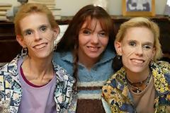 Τραγικό τέλος για τις ανορεξικές δίδυμες