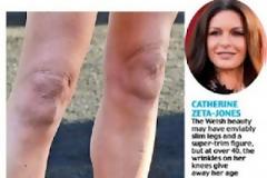 ΔΕΙΤΕ: Το σημείο του σώματος που προδίδει την πραγματική ηλικία κάποιων διασήμων γυναικών!