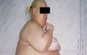 ΣΟΚΑΡΙΣΤΙΚΗ ΦΩΤΟ: Αφαίρεσαν λίπος 57 κιλών από την κοιλιά μιας Ρωσίδας