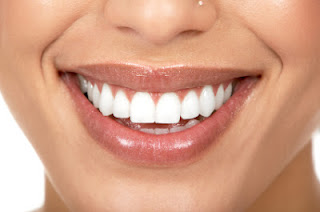 Τρικ για να δείχνουν τα δόντια σας πιο... λευκά - Φωτογραφία 1