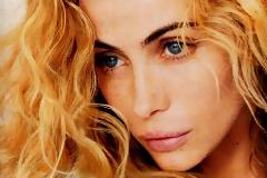 5 αστέρες μετανιώνουν για τις πλαστικές τους