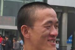 Ο μοναδικός άνθρωπος που μπορεί να δαγκώσει.. τη μύτη του