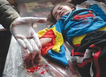 Οι εισαγόμενοι μισθοφόροι αντάρτες της Συρίας σκοτώνουν και παιδιά - Φωτογραφία 1