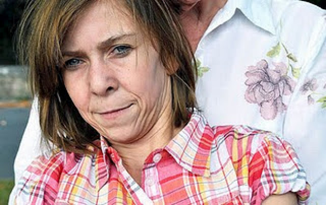 Δείτε την έφηβη που εξαιτίας σπάνιας νόσου μοιάζει μεσήλικη - Φωτογραφία 2