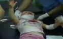 Συρία: Συγκλονιστικό βίντεο, πατέρας προσπαθεί να σώσει το παιδί του