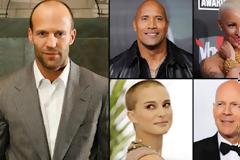 ΔΕΙΤΕ:Οι πιο σέξι καραφλοί celebrities